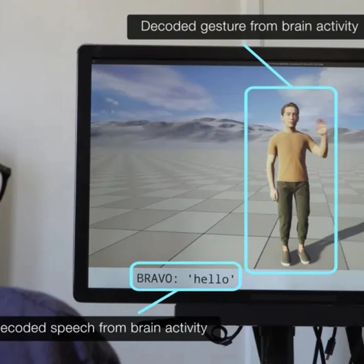 Implante cerebral permite que pessoas paralisadas se comuniquem por avatar